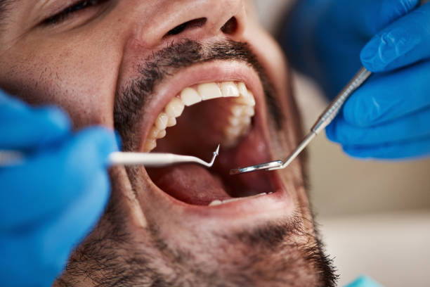 Best Weekend Emergency Dentist in Lake Sconsin, WI